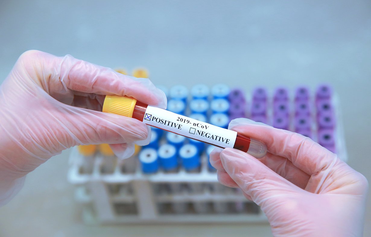 Blood Test To Diagnose Illness & Infection