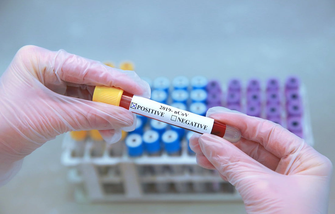 Blood Test To Diagnose Illness & Infection